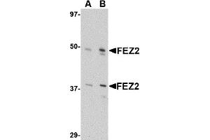 Western Blotting (WB) image for anti-Fasciculation and Elongation Protein zeta 2 (Zygin II) (FEZ2) (Middle Region) antibody (ABIN1030932)