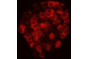 Immunocytochemistry (ICC) image for anti-Cadherin EGF LAG Seven Pass G-Type Receptor 2 (CELSR2) antibody (ABIN1112870) (CELSR2 Antikörper)