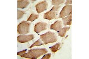 Image no. 2 for anti-Actin Related Protein 2/3 Complex, Subunit 1A, 41kDa (ARPC1A) (C-Term) antibody (ABIN452762) (ARPC1A Antikörper  (C-Term))