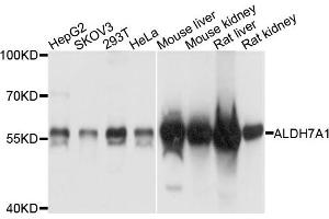 Western blot analysis of extracts of various cells, using ALDH7A1 antibody. (ALDH7A1 Antikörper)