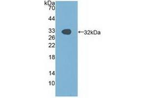 Detection of Recombinant PAK1, Human using Polyclonal Antibody to p21 Protein Activated Kinase 1 (PAK1) (PAK1 Antikörper  (AA 252-501))