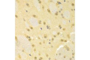 Immunohistochemistry of paraffin-embedded rat brain using SMAD1 antibody. (SMAD1 Antikörper  (AA 20-240))