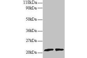 Western blot All lanes: ARL2 antibody at 2 μg/mL Lane 1: EC109 whole cell lysate Lane 2: 293T whole cell lysate Secondary Goat polyclonal to rabbit IgG at 1/15000 dilution Predicted band size: 21, 19 kDa Observed band size: 21 kDa (ARL2 Antikörper  (AA 19-184))