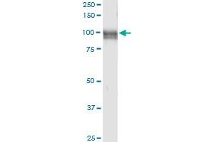 Immunoprecipitation (IP) image for anti-Membrane Metallo-Endopeptidase (MME) (AA 1-750) antibody (ABIN948133)