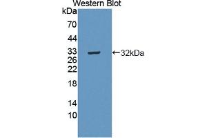 Detection of Recombinant MERTK, Human using Polyclonal Antibody to C-Mer Proto Oncogene Tyrosine Kinase (MERTK) (MERTK Antikörper  (AA 587-858))