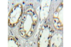 Used in DAB staining on fromalin fixed paraffin-embedded Kidney tissue (ITGAD Antikörper  (AA 886-1106))