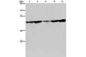 Western Blot analysis of Human fetal liver tissue, HT-29 and HUVEC cell, MCF-7 cell and Human hepatocellular carcinoma tissue using CERS4 Polyclonal Antibody at dilution of 1:300 (LASS4 Antikörper)
