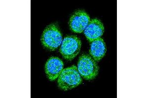 Confocal immunofluorescent analysis of CTNB1 Antibody (C-term) (ABIN655178 and ABIN2844795) with 293 cell followed by Alexa Fluor 488-conjugated goat anti-rabbit lgG (green). (CTNNB1 Antikörper  (C-Term))