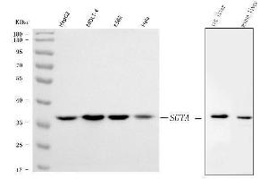 Western blot analysis of SGTA using anti-SGTA antibody (ABIN7599212).