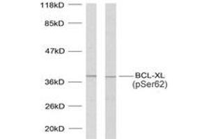 Western blot analysis of extracts from 293 cells treated with UV and MDA-MB-435 cells treated with UV, using BCL-XL (Phospho-Ser62) Antibody. (BCL2L1 Antikörper  (pSer62))