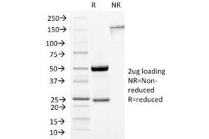 SDS-PAGE Analysis Purified Growth Hormone Mouse Monoclonal Antibody (GH/1450). (Growth Hormone 1 Antikörper  (AA 58-187))