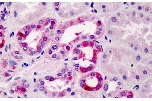 ABIN334506 (5µg/ml) staining of paraffin embedded Human Kidney. (TFEC Antikörper  (Internal Region))