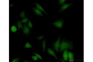 Immunofluorescence of monoclonal antibody to UBE2G1 on HeLa cell. (UBE2G1 Antikörper  (AA 1-170))