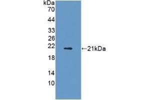 Adiponectin Receptor 2 Antikörper  (AA 1-147)