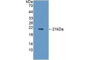 Adiponectin Receptor 2 anticorps  (AA 1-147)