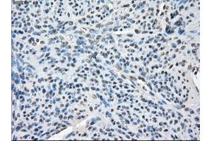 Immunohistochemical staining of paraffin-embedded colon tissue using anti-BUB1Bmouse monoclonal antibody. (BUB1B Antikörper)