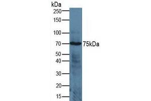 Detection of ADAM17 in Human Jurkat Cells using Polyclonal Antibody to A Disintegrin And Metalloprotease 17 (ADAM17) (ADAM17 Antikörper  (AA 226-473))
