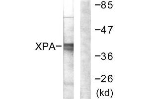 Western blot analysis of extracts from COLO205 cells, using XPA antibody. (XPA Antikörper  (C-Term))