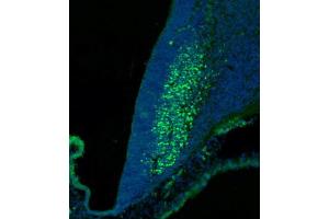 Immunofluorescence (IF) image for anti-SKI Family Transcriptional Corepressor 2 (SKOR2) (AA 741-775), (C-Term) antibody (ABIN6244147)