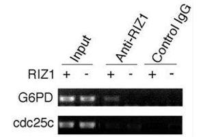 ChIP analysis was performed on RIZ1 knockout mouse embryonic fibroblasts with RIZ1 antibody. (PRDM2 Antikörper  (AA 1-347))
