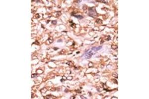 Image no. 2 for anti-Tumor Protein P53 (TP53) (pThr18) antibody (ABIN358195) (p53 Antikörper  (pThr18))