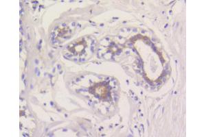 Immunohistochemistry of paraffin-embedded human breast using MCL1 antibody (ABIN5997051) at dilution of 1/100 (40x lens). (MCL-1 Antikörper)