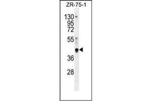 Western blot analysis of PYGO1 Antibody (C-term) in ZR-75-1 cell line lysates (35ug/lane).