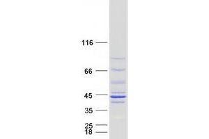 Validation with Western Blot (NDUFAF1 Protein (Myc-DYKDDDDK Tag))