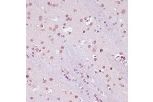 Immunohistochemistry (IHC) image for anti-Lysine (K)-Specific Demethylase 1A (KDM1A) (AA 130-380) antibody (ABIN7268323)