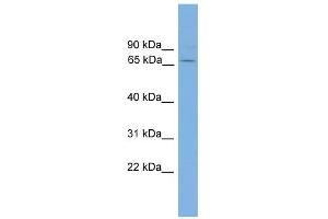 WB Suggested Anti-GAD1 Antibody Titration: 0.