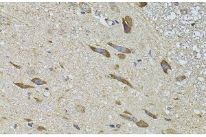 Immunohistochemistry of paraffin-embedded Rat spinal cord using ADRBK2 Polyclonal Antibody at dilution of 1:100 (40x lens). (ADRBK2 Antikörper)