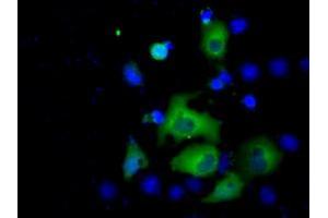 Image no. 4 for anti-Acetyl-CoA Acetyltransferase 2 (ACAT2) antibody (ABIN1496397) (ACAT2 Antikörper)