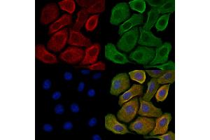 ABIN7093304 and ABIN7097323 staining H2O2 treated Hela cells by IF/ICC. (ERK1 Antikörper  (pTyr205, pTyr222))