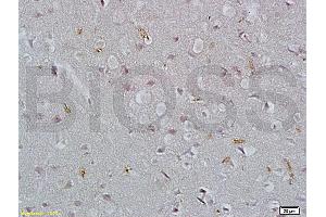 Formalin-fixed and paraffin embedded rat brain tissue labeled with Rabbit Anti-EpCAM/CD326 Polyclonal Antibody (ABIN670611), Unconjugated at 1:200 followed by conjugation to the secondary antibody and DAB staining.