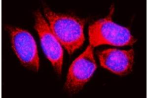 IF analysis of RPL11 using anti-RPL11 antibody (ABIN7602315).