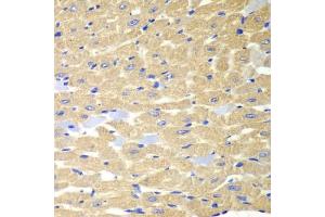Immunohistochemistry (IHC) image for anti-Rabphilin 3A (RPH3A) (AA 1-280) antibody (ABIN6147094)