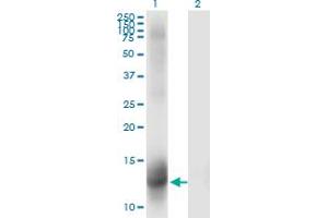 Western Blotting (WB) image for anti-Nuclear Receptor Subfamily 3, Group C, Member 2 (NR3C2) (AA 1-110) antibody (ABIN561832)