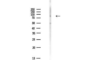 Western blot analysis of lysates from HepG2 cells(LPS,4h treatment), using Phospho-PKC alpha (Thr638) Antibody at 1/1000 dilution.