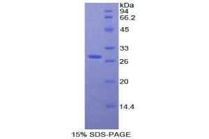 SDS-PAGE analysis of Rat aHSG Protein.