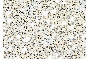ABIN6263108 and ABIN6266800 at 1/100 staining Rat kidney tissue by IHC-P.