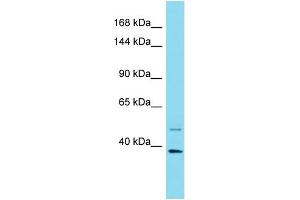 Host:  Rabbit  Target Name:  PER1  Sample Type:  Breast Tumor lysates  Antibody Dilution:  1. (PER1 Antikörper  (N-Term))