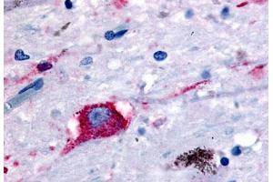 Anti-NPBWR2 antibody  ABIN1049112 IHC staining of human brain, neurons and glia. (NPBWR2 Antikörper  (N-Term))
