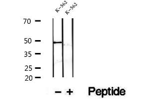 Western blot analysis of extracts of K-562 cells, using FECH antibody. (FECH Antikörper  (C-Term))