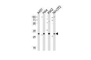 Western blot analysis of lysates from A431, Hela, K562, mouse NIH/3T3 cell line (from left to right), using CDK5 Antibody (C-term) (ABIN6242783 and ABIN6577637). (CDK5 Antikörper  (C-Term))