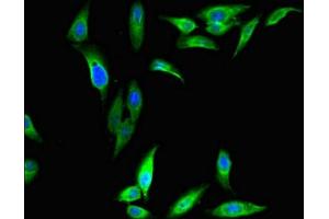 Immunofluorescent analysis of Hela cells using ABIN7149493 at dilution of 1:100 and Alexa Fluor 488-congugated AffiniPure Goat Anti-Rabbit IgG(H+L) (DAZAP1 Antikörper  (AA 1-300))