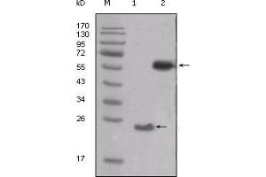 Western blot analysis using SRC mouse mAb against truncated SRC-His recombinant protein (1) and PMA treated THP-1 cell lysate (2). (Src Antikörper  (AA 10-193))