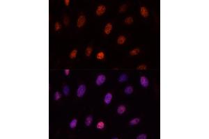 Immunofluorescence analysis of U-2OS cells using PCGF1 antibody (ABIN6129080, ABIN6145307, ABIN6145308 and ABIN6221952) at dilution of 1:100. (PCGF1 Antikörper  (AA 20-259))