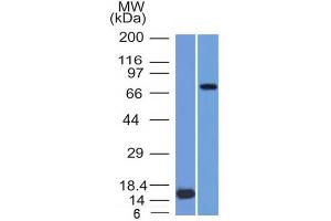 Western Blot of (1) Recombinant MMP2 protein and (2) U87 cell lysate using MMP2 Monoclonal Antibody (MMP2/1501). (MMP2 Antikörper  (AA 444-575))