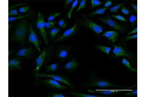 Immunofluorescence (IF) image for anti-DnaJ (Hsp40) Homolog, Subfamily C, Member 30 (DNAJC30) (AA 1-226) antibody (ABIN529633)
