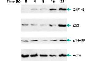 Western blot analysis of AGS (gastric carcinoma) cells with ZNF148 polyclonal antibody . (ZNF148 Antikörper)
